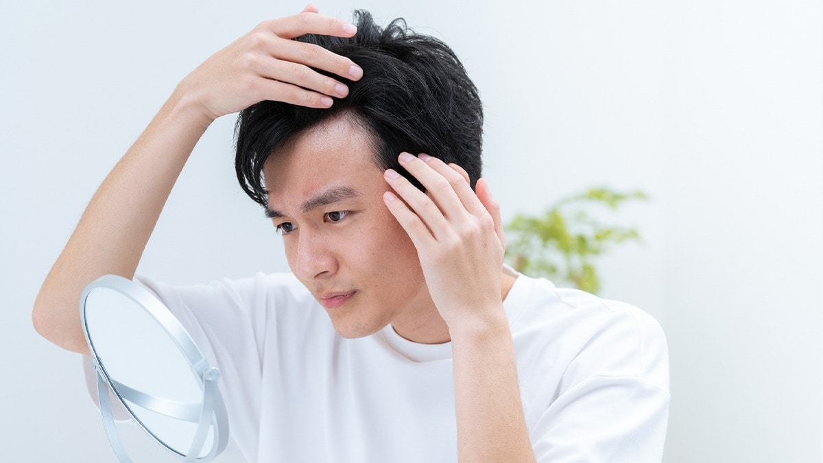 生え際(こめかみ、もみあげなど)の男性白髪を目立たなくする方法は?