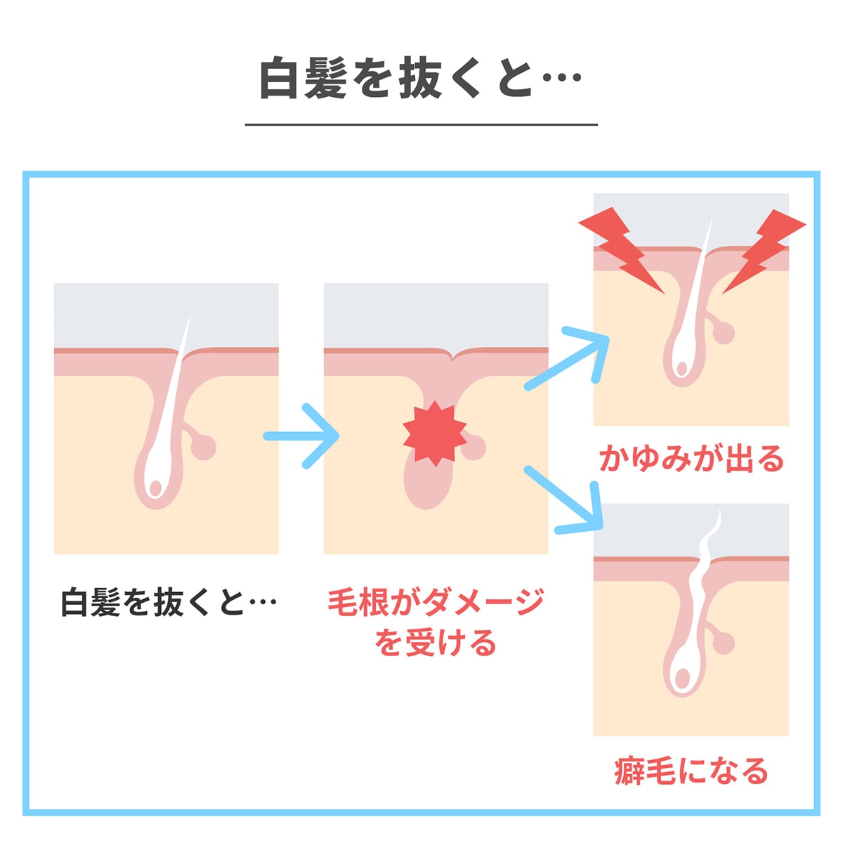 白髪を抜いた際に頭皮で起こっていることのイメージ